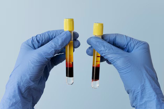 Hematuria